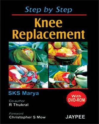 Step by Step Knee Replacement