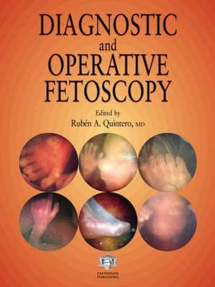 Diagnostic and Operative Fetoscopy