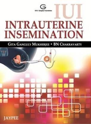 IUI Intrauterine Insemination