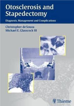 Otosclerosis and Stapedectomy
