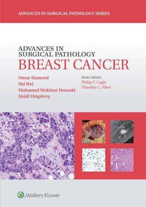 Advances in Surgical Pathology: Breast Cancer