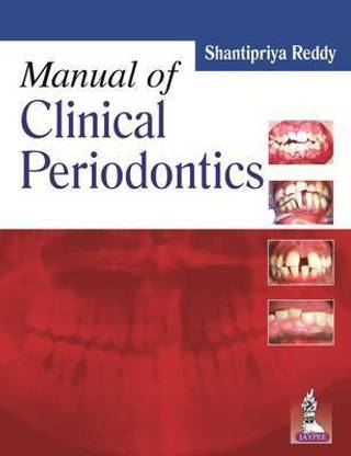 Manual of Clinical Periodontics