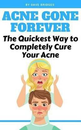 Acne Gone Forever