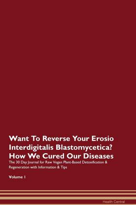 Want To Reverse Your Erosio Interdigitalis Blastomycetica? How We Cured Our Diseases. The 30 Day Journal for Raw Vegan Plant-Based Detoxification & Regeneration with Information & Tips Volume 1