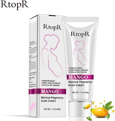RtopR Natural Herbal Mango Anti Stretch Marks Cream