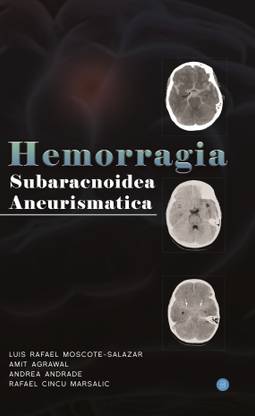 Hemorragia Subaracnoidea Aneurismatica