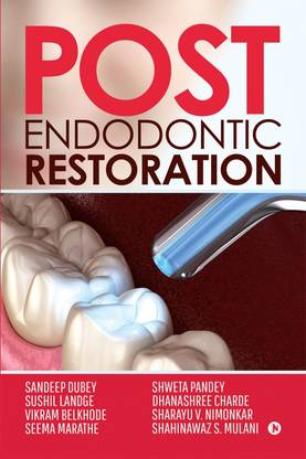 Post Endodontic Restoration