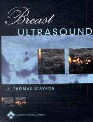 Breast Ultrasound