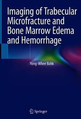 Imaging of Trabecular Microfracture and Bone Marrow Edema and Hemorrhage