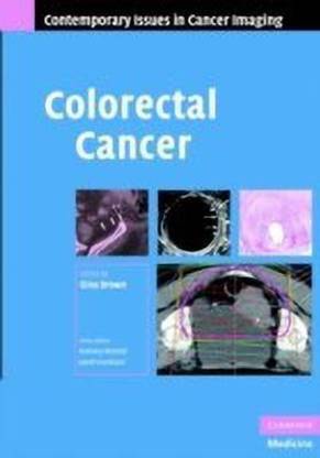 Colorectal Cancer