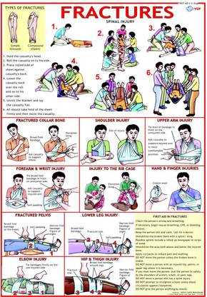 First Aid chart - Fractures Photographic Paper