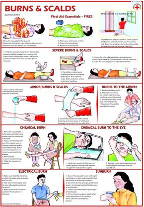 First Aid chart - Burns and Scalds Photographic Paper