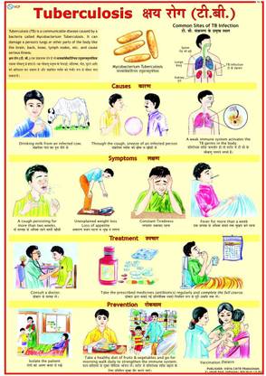 Tuberculosis Chart (TB) Photographic Paper