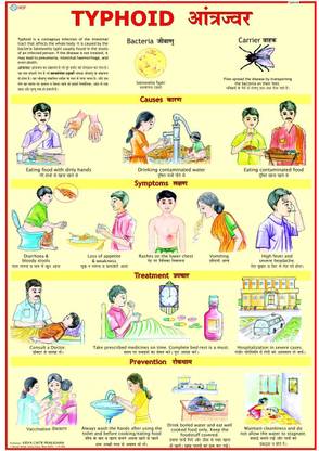 Typhoid Chart Photographic Paper