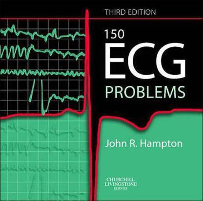 150 ECG Problems, International Edition 3rd Edition