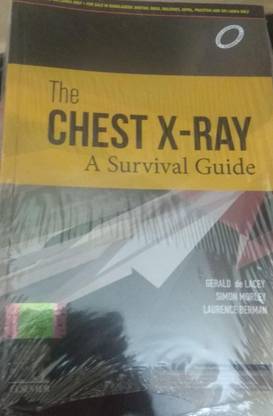 The Chest X-Ray A Survival Guide