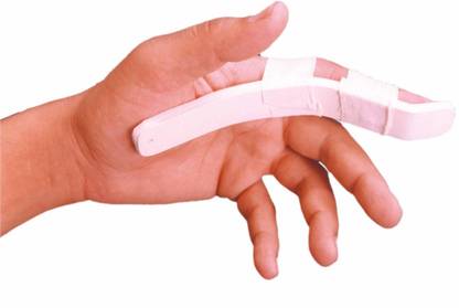 Grip's Spoon Splint 6" | Emergency and Trauma Splints | Support for Fingers (S 05) Splints