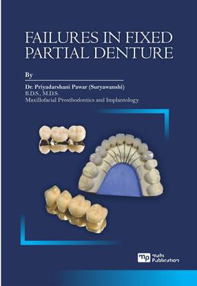 FAILURES IN FIXED PARTIAL DENTURE