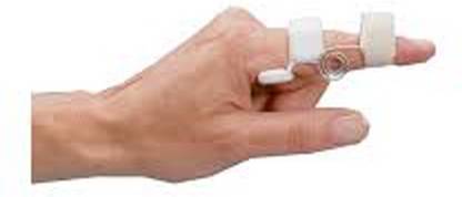 Saket Ortho Rehab International Private Limited Capner Splint (Medium) Splints