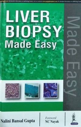 Liver Biopsy Made Easy
