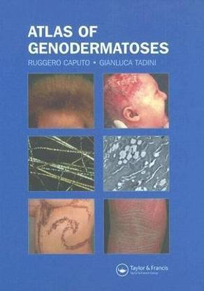 Atlas of Genodermatoses