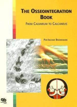The Osseointegration Book
