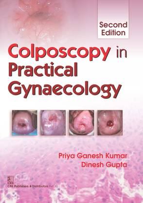 Colposcopy in Practical Gynecology