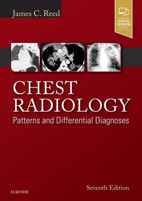 Chest Radiology