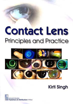 Contact Lens