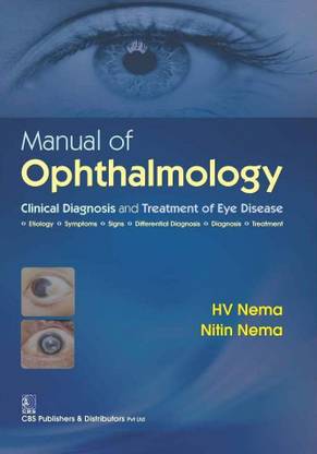 Manual of Ophthalmology : Clinical Diagnosis and Treatment of Eye Disease