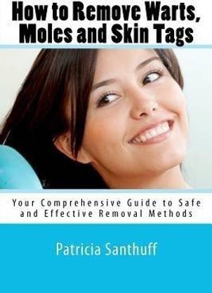 How to Remove Warts, Moles and Skin Tags