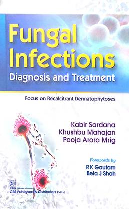 Fungal Infections