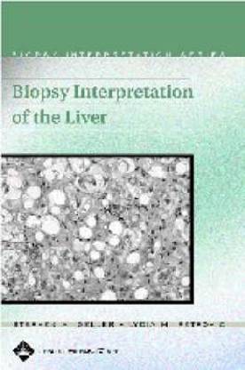 Biopsy Interpretation of the Liver