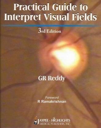 Practical Guide to Interpret Visual Fields