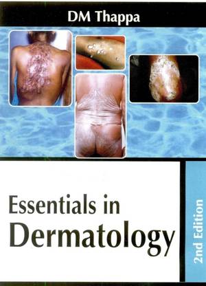 Essentials in Dermatology
