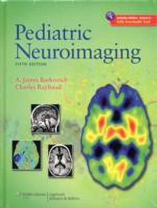 Pediatric Neuroimaging