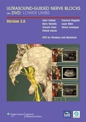 Ultrasound-guided Nerve Blocks on DVD Vs 2.0 : Lower Limbs for MAC