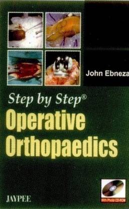 Step by Step: Operative Orthopaedics