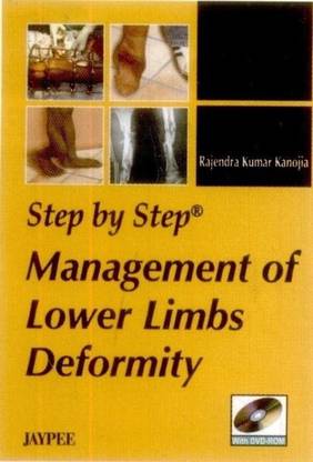Step by Step: Management of Lower Limbs Deformity