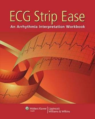ECG Strip Ease
