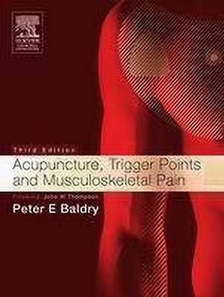 Acupuncture, Trigger Points and Musculoskeletal Pain