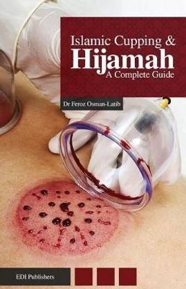 Islamic Cupping & Hijamah  - A Complete Guide