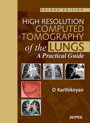 High Resolution Computed Tomography of the Lungs: A Practical Guide 2nd ...