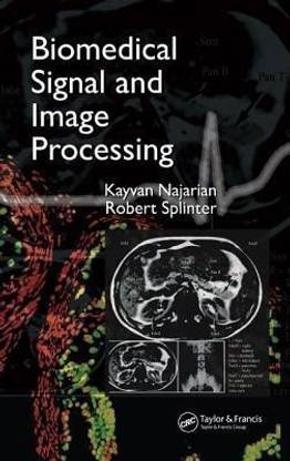 Biomedical Signal and Image Processing