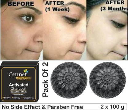 CENNET  Activated Charcoal Soap For Women Skin Whitening , Pimples, Blackheads , Acne, Natural Detox Face Soap Face & Body Soap