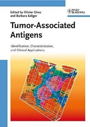 Tumor-Associated Antigens  - Identification, Characterization, and Clinical Applications