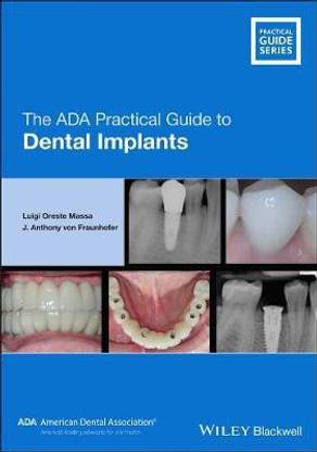 The ADA Practical Guide to Dental Implants