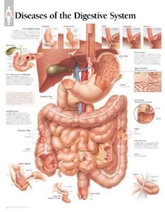 Diseases of the Digestive System Paper Poster