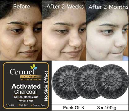 CENNET Charcoal Soap For Women Skin Whitening | Acne , Blackhead , Pimples Skin care soap
