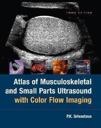 Atlas Of Musculoskeletal and Small Parts Ultrasound with Color Flow Imaging